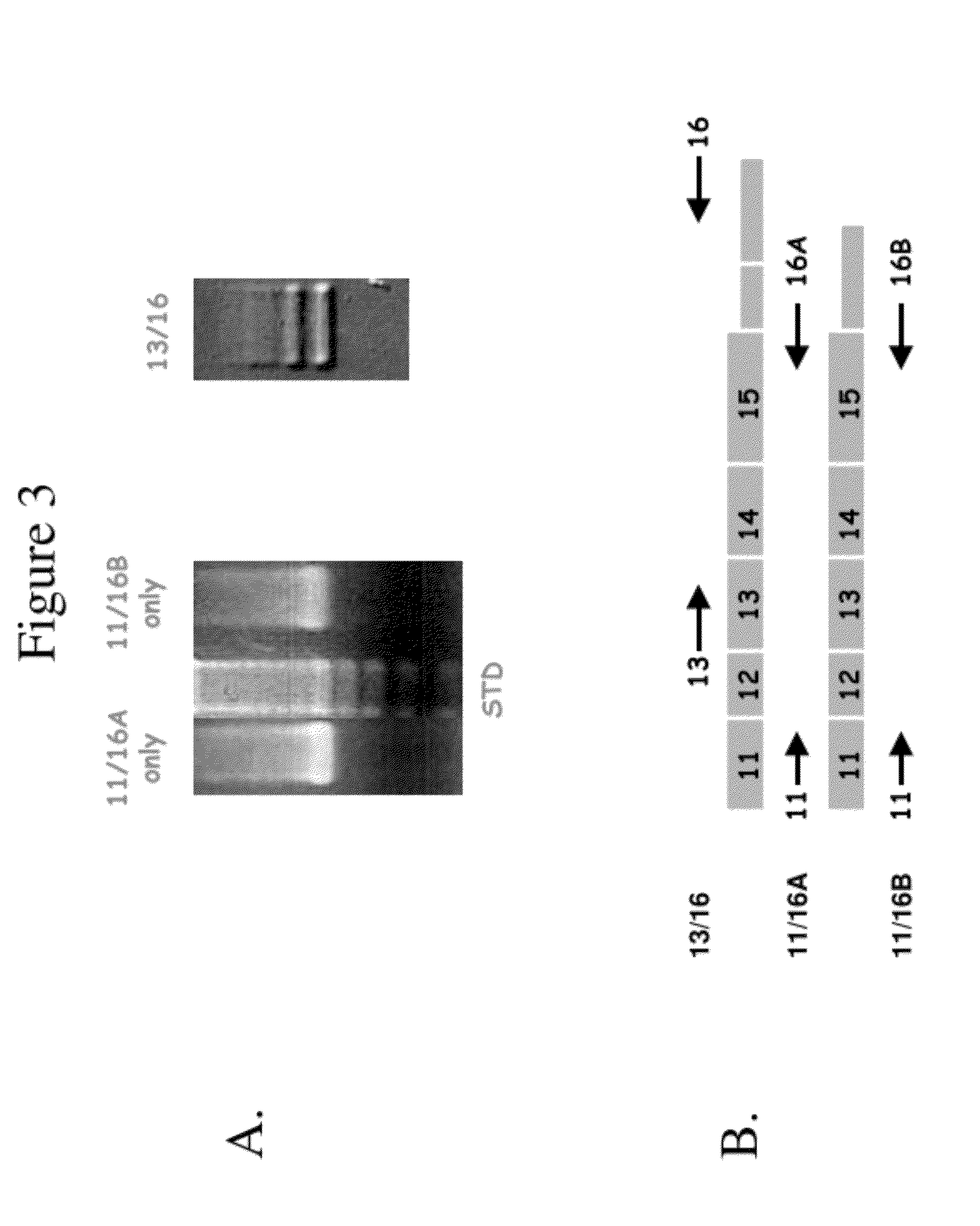 Method of diagnosing and treating cancer using b-catenin splice variants