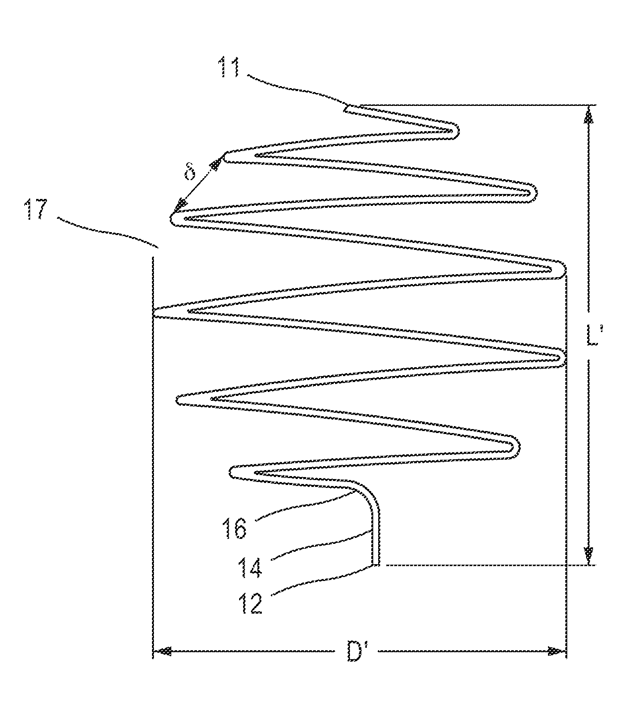 Systems, methods and devices for embolic protection