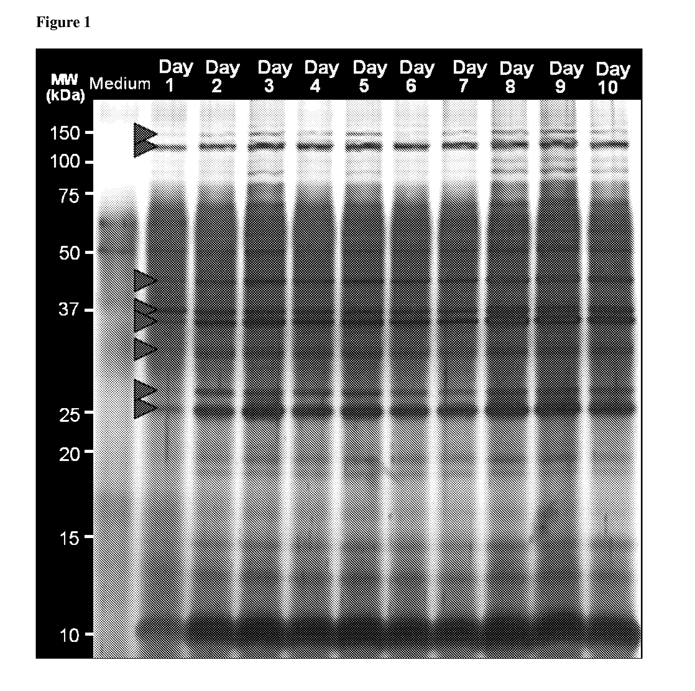 Proteomics based diagnostic detection method for chronic sinusitis