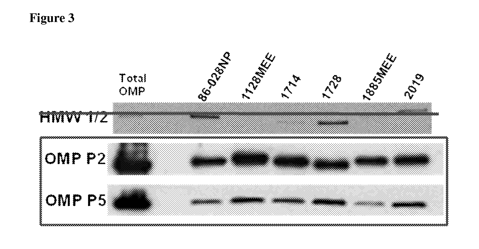 Proteomics based diagnostic detection method for chronic sinusitis