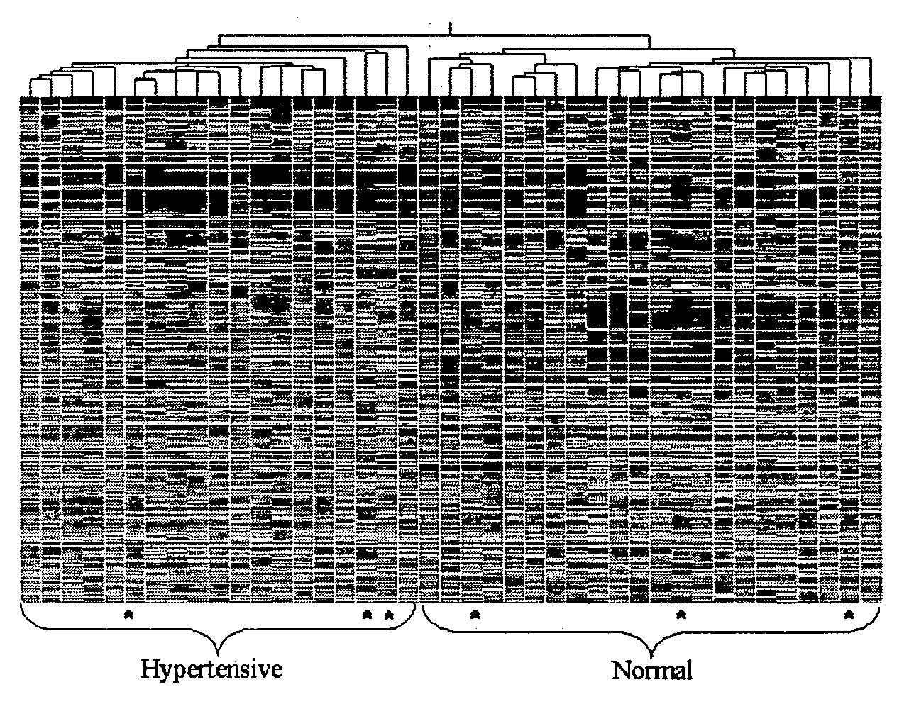 Method for the detection of gene transcripts in blood and uses thereof