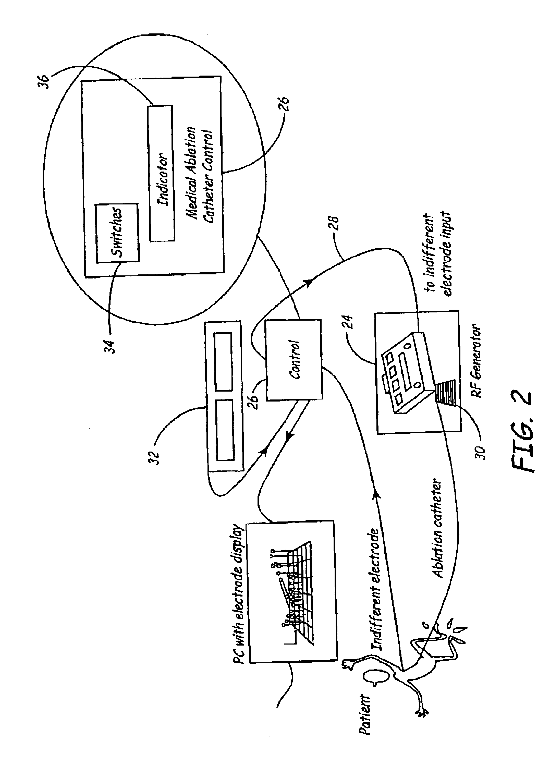 Medical ablation catheter control