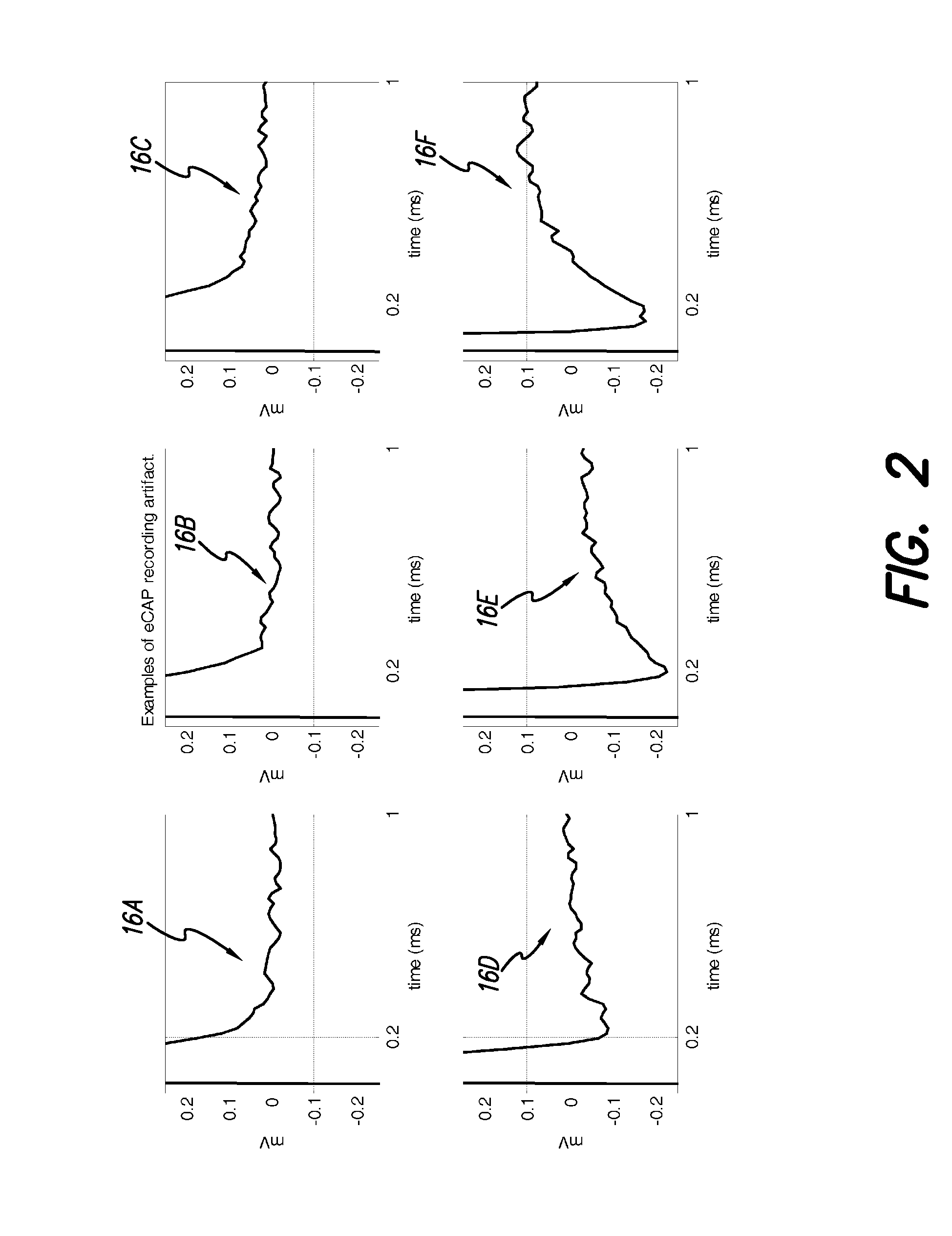 Removing Artifact in Evoked Compound Action Potential Recordings in Neural Stimulators