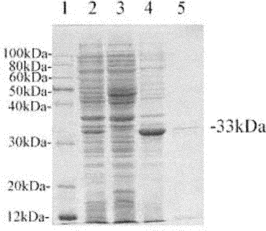 Trichina Ts27 gene, encoding protein and application thereof