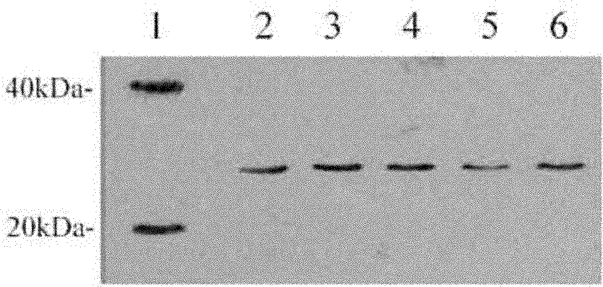 Trichina Ts27 gene, encoding protein and application thereof