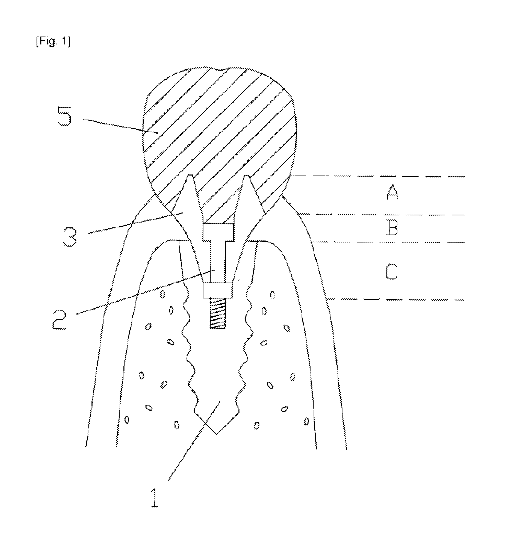 Abutment capable of accommodating core crowns manufactured at various angles and functioning as a healing abutment having a cap attached thereto, method for manufacturing dental implant prostheses using the abutment, and method for implant surgery using the abutment