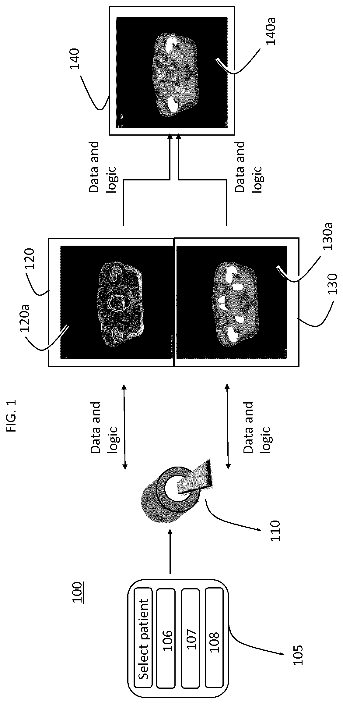 Medical product configured to be used for image based radiotherapy planning