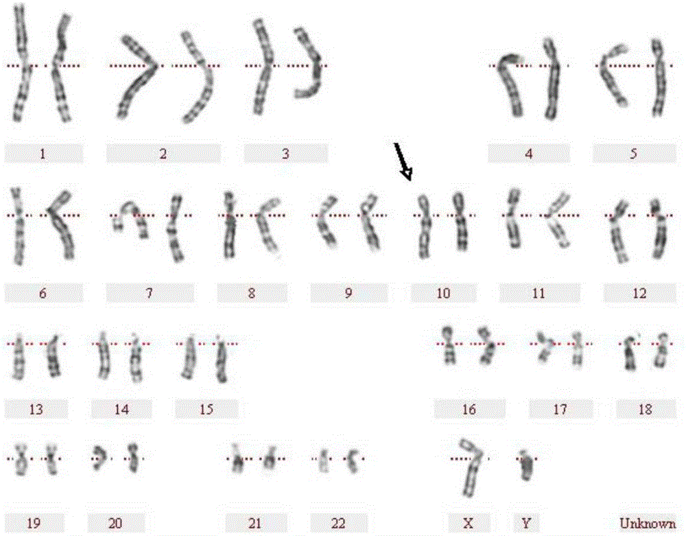 Human peripheral blood chromosome synchronization preparation kit