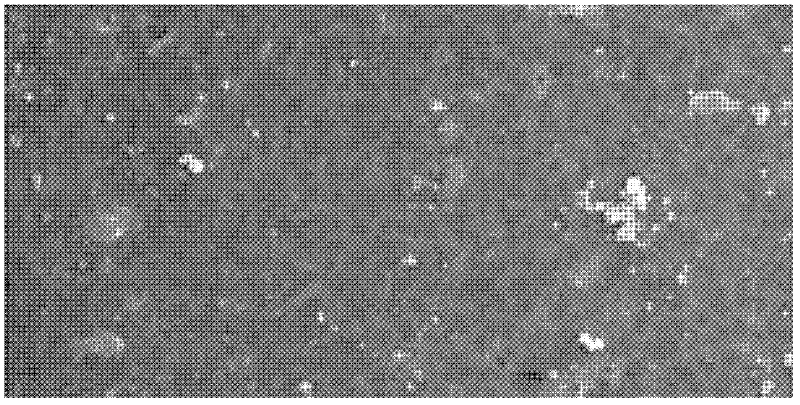 Biological enzyme sensor capable of being implanted into human body and production method thereof