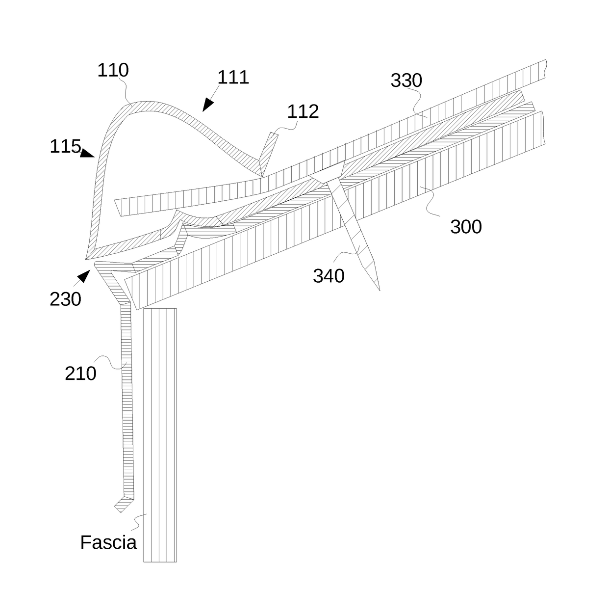 Roof edge structure for securing roofing materials