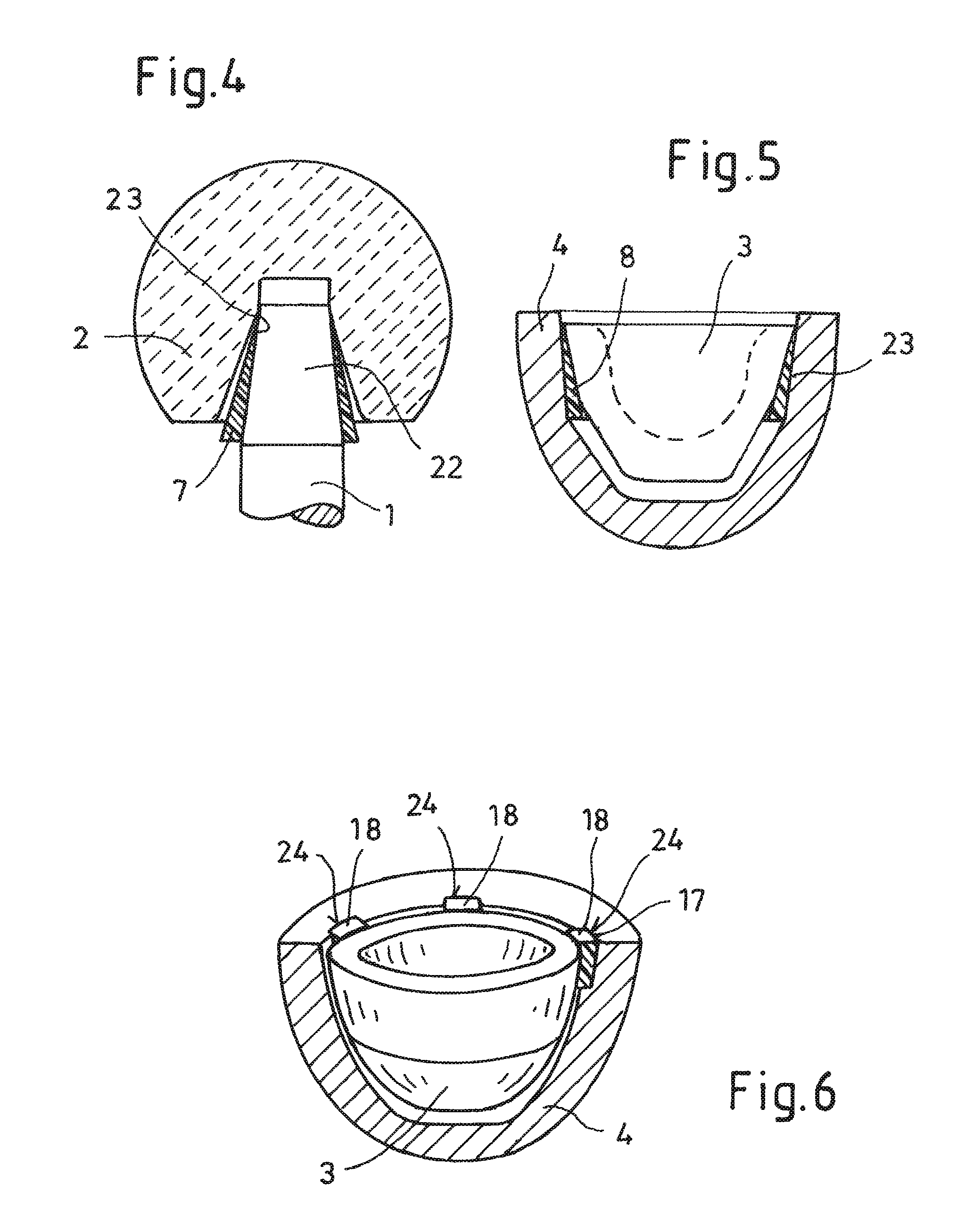 Insertion of vibration-damping elements in prosthetic systems for the manipulation and damping of natural frequencies