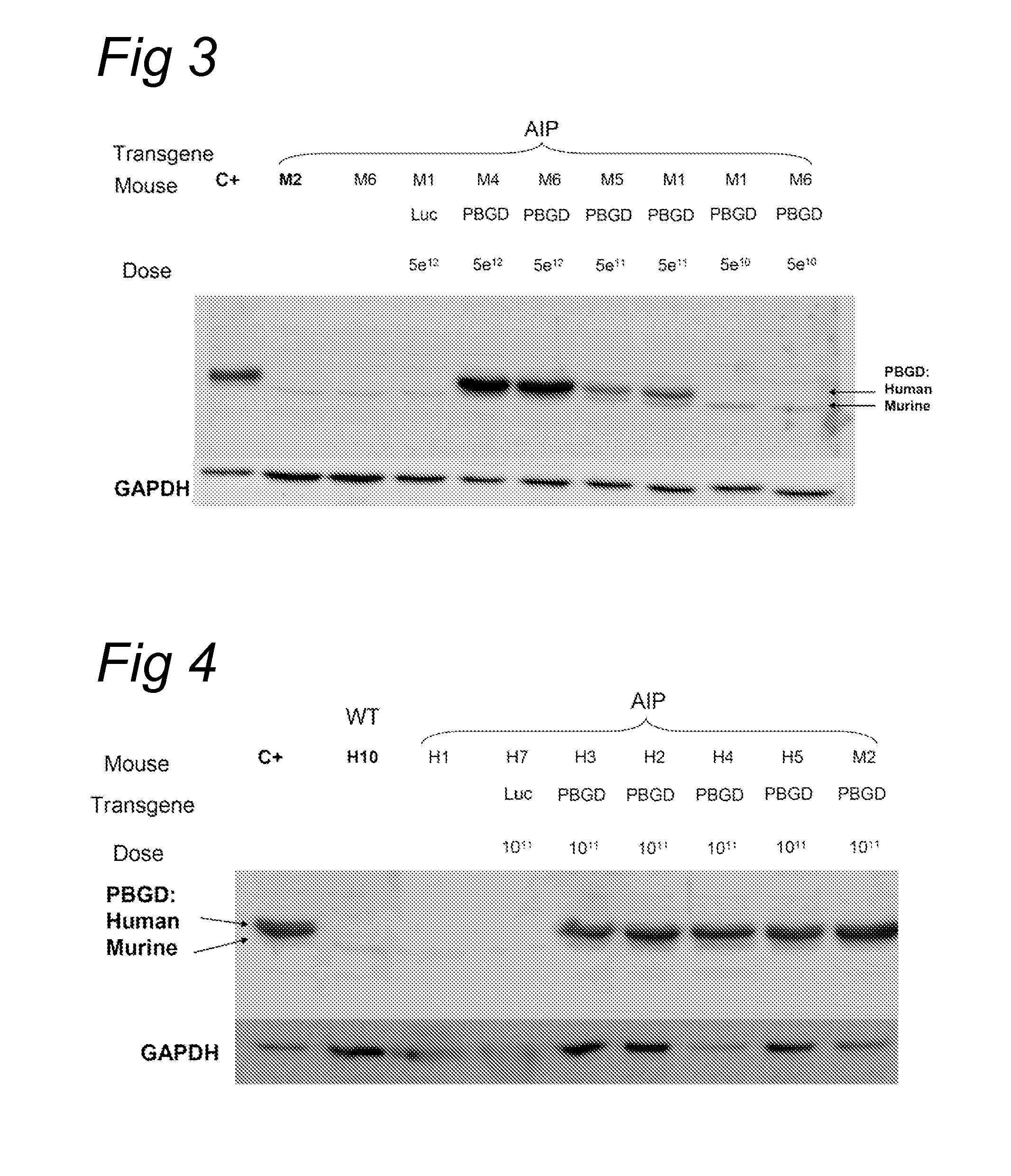 Porphobilinogen deaminase gene therapy