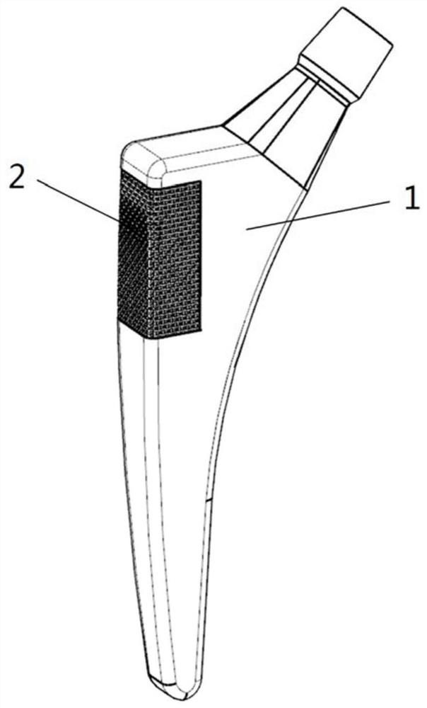 A femoral stem prosthesis