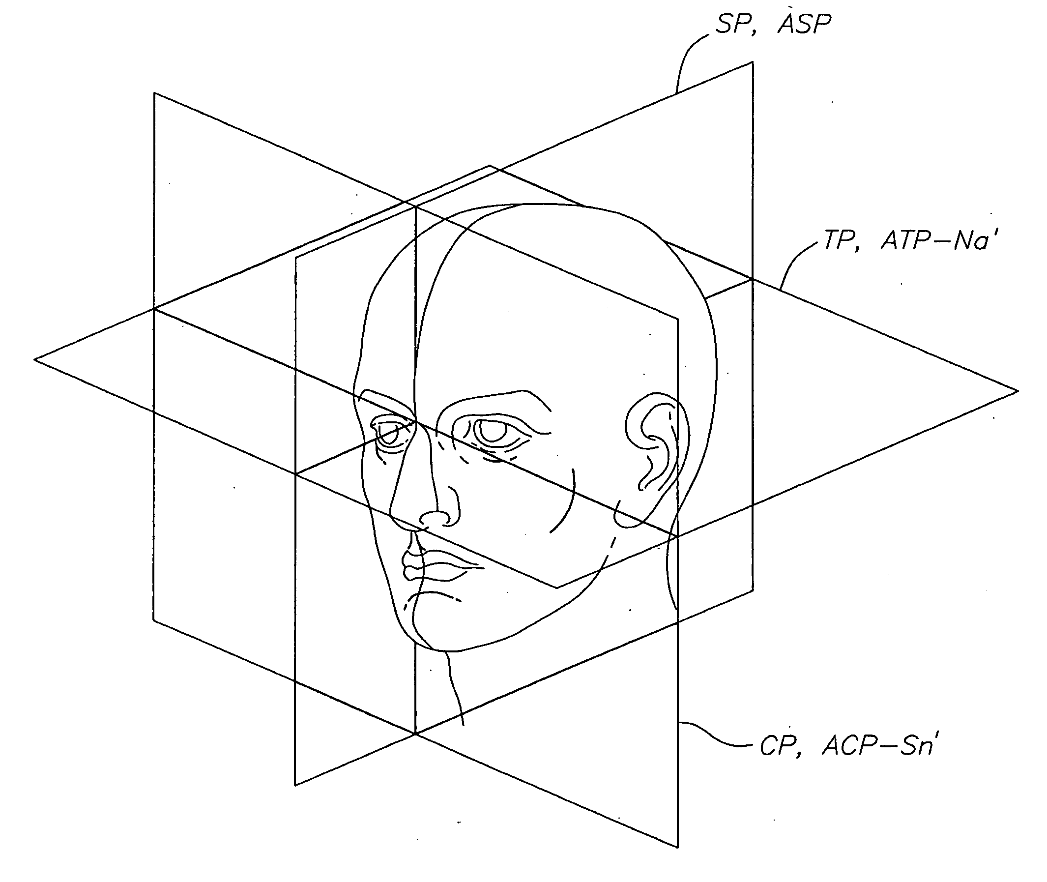 Method for determining the correct natural head position location of references planes relative to a three-dimensional computerized image of a patient's head