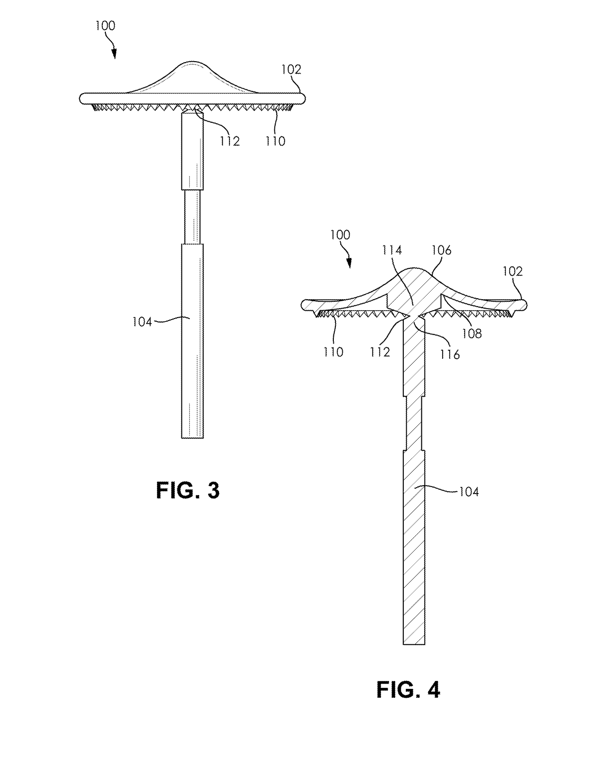 Encephalocele repair device