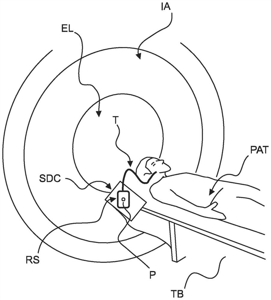 Chemoreceptor stimulation for sedative state survey