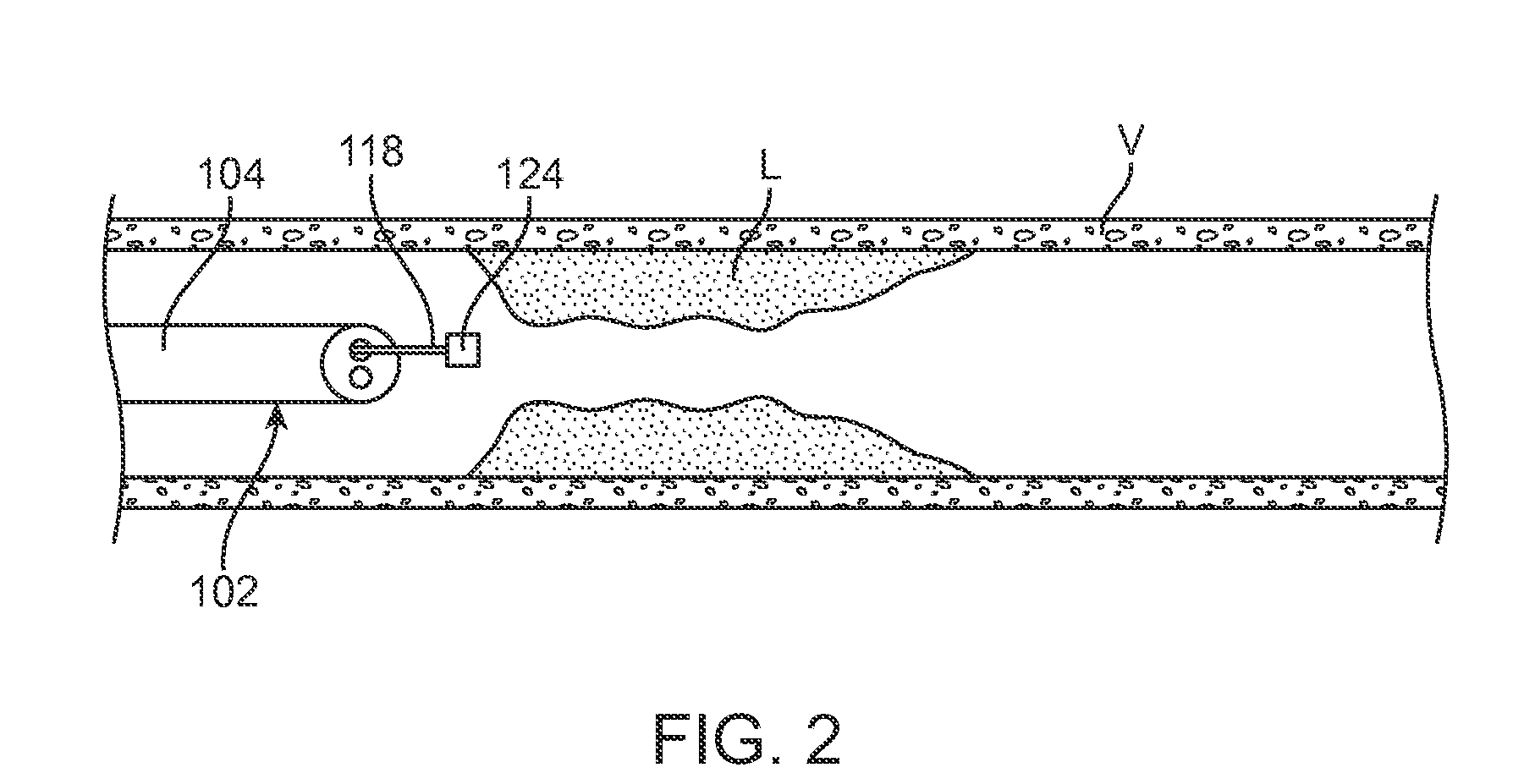 Systems and methods for determining fractional flow reserve without adenosine or other pharmalogical agent