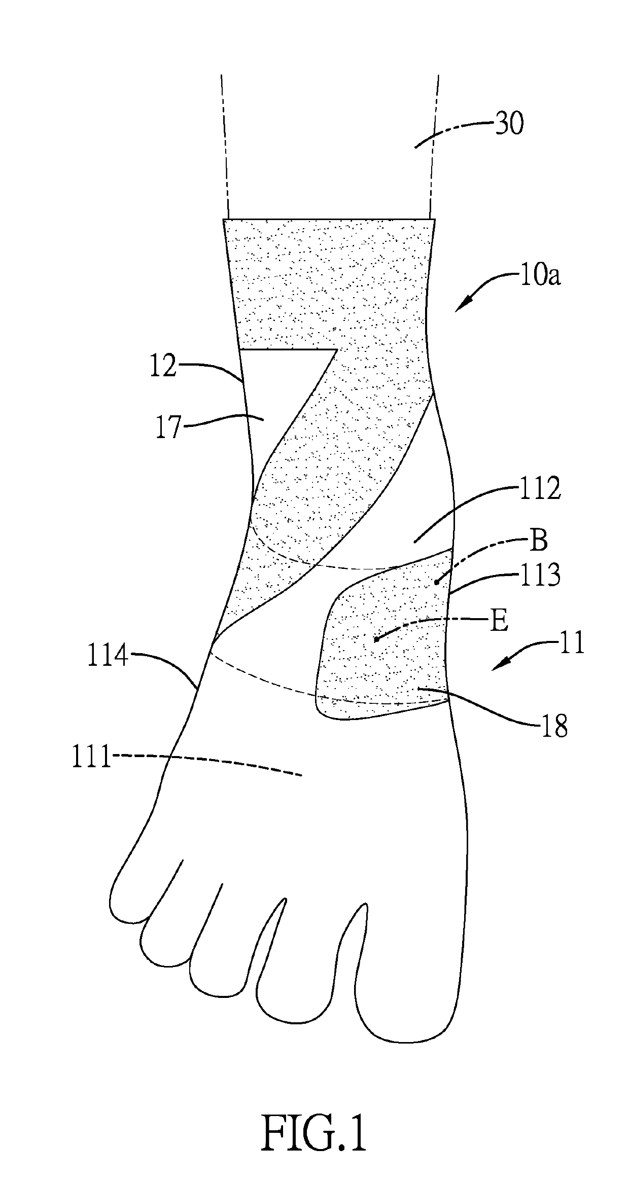 High-arched foot orthosis