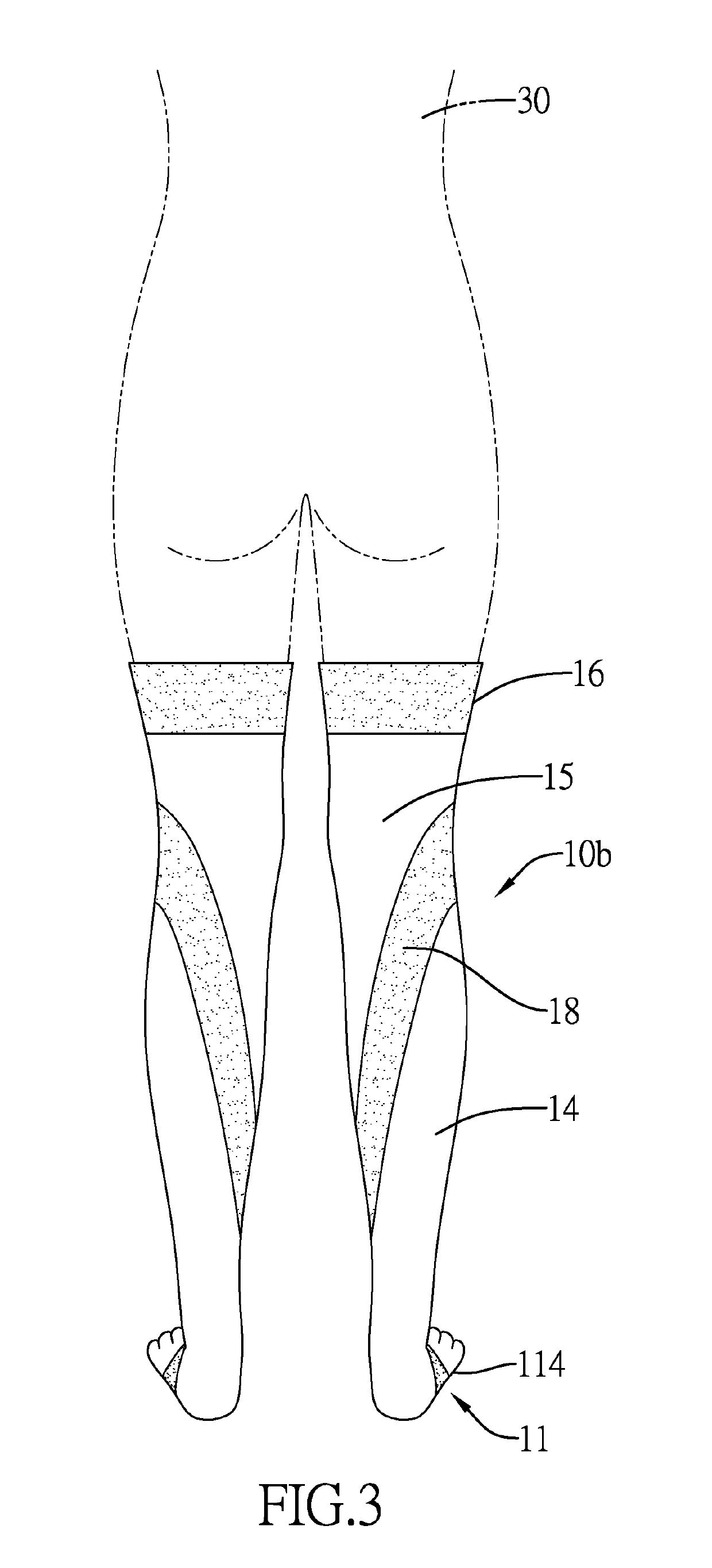 High-arched foot orthosis