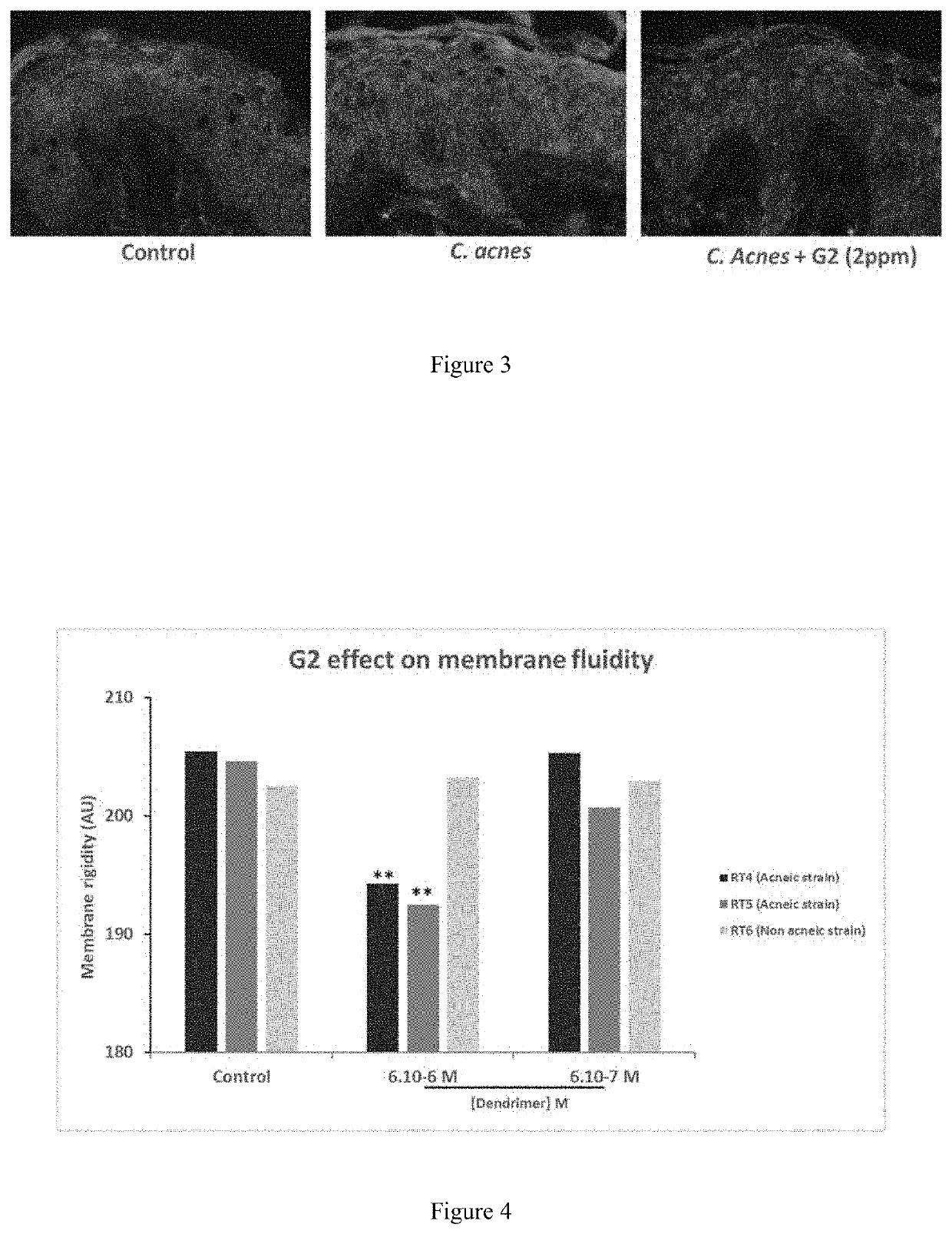 Use of polylysine dendrimers in the prevention and management of acne-prone skin and acenic skin