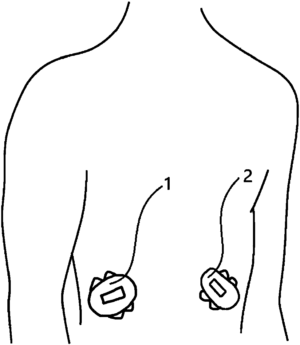 Loop close control system and method in artificial pancreas