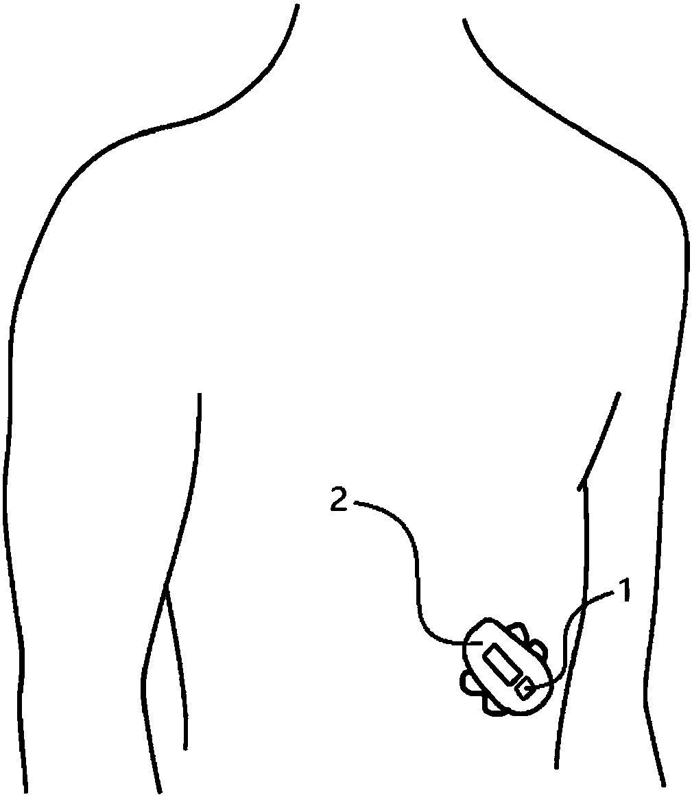 Loop close control system and method in artificial pancreas