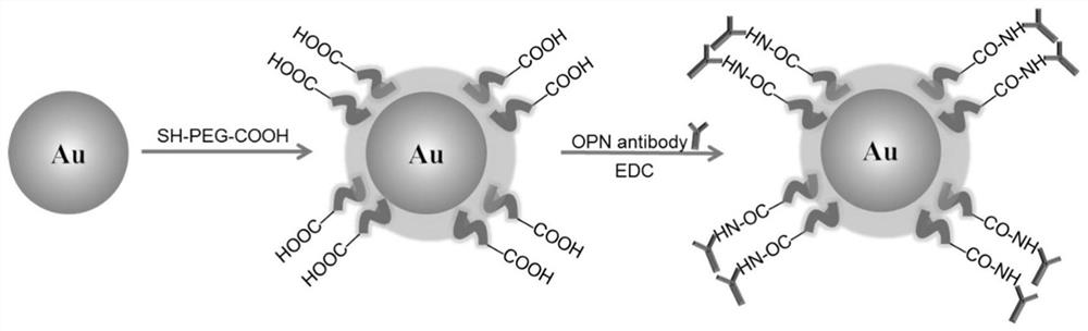 A nanoprobe for CT imaging of Kawasaki disease coronary artery disease and its preparation method and application