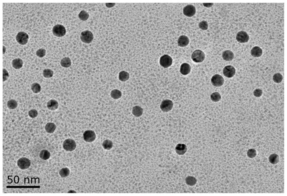 A nanoprobe for CT imaging of Kawasaki disease coronary artery disease and its preparation method and application