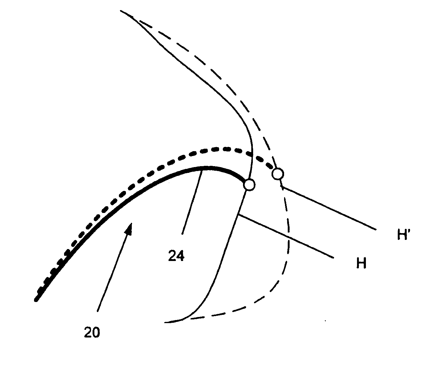 Electrophysiology catheter and system for gentle and firm wall contact