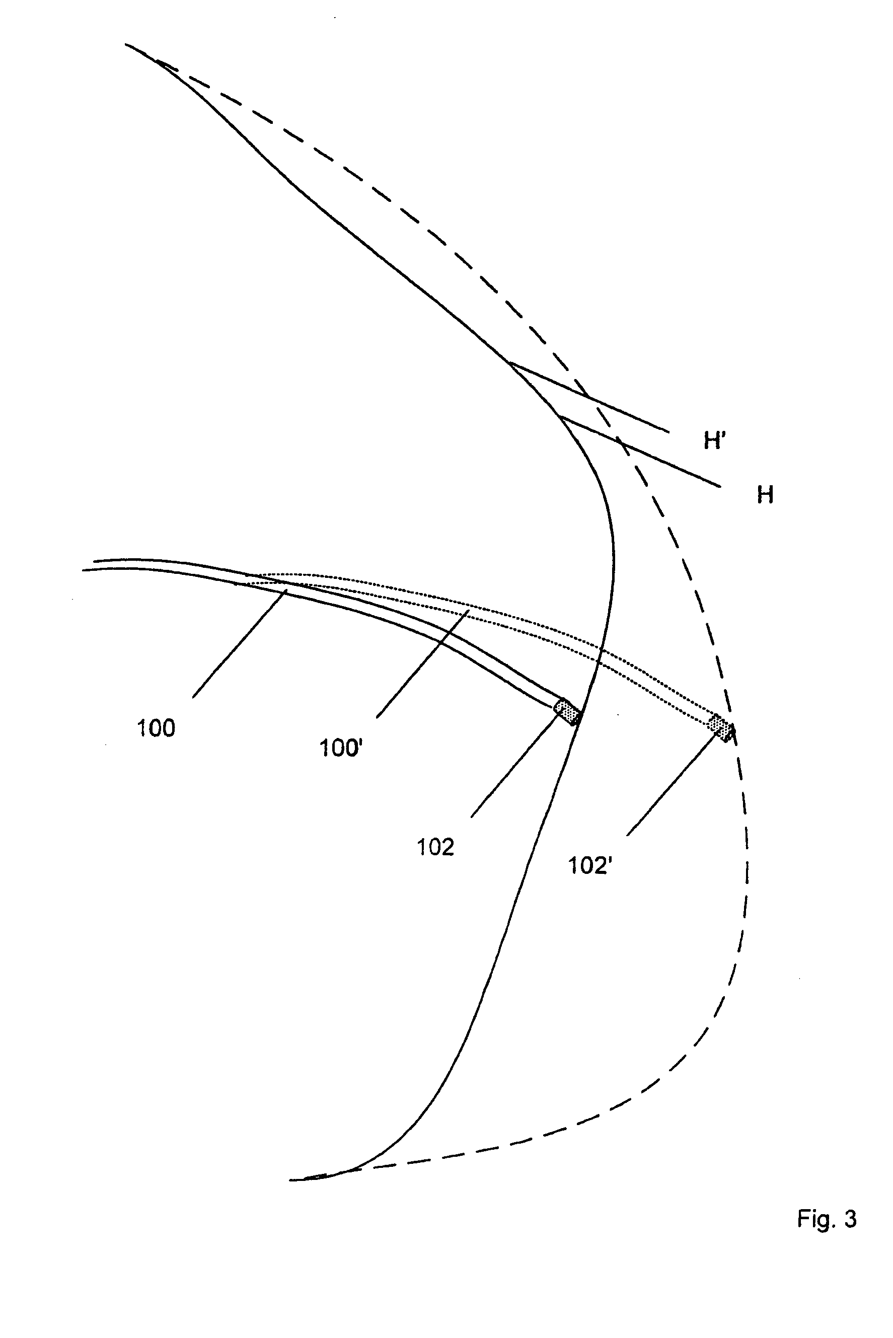 Electrophysiology catheter and system for gentle and firm wall contact