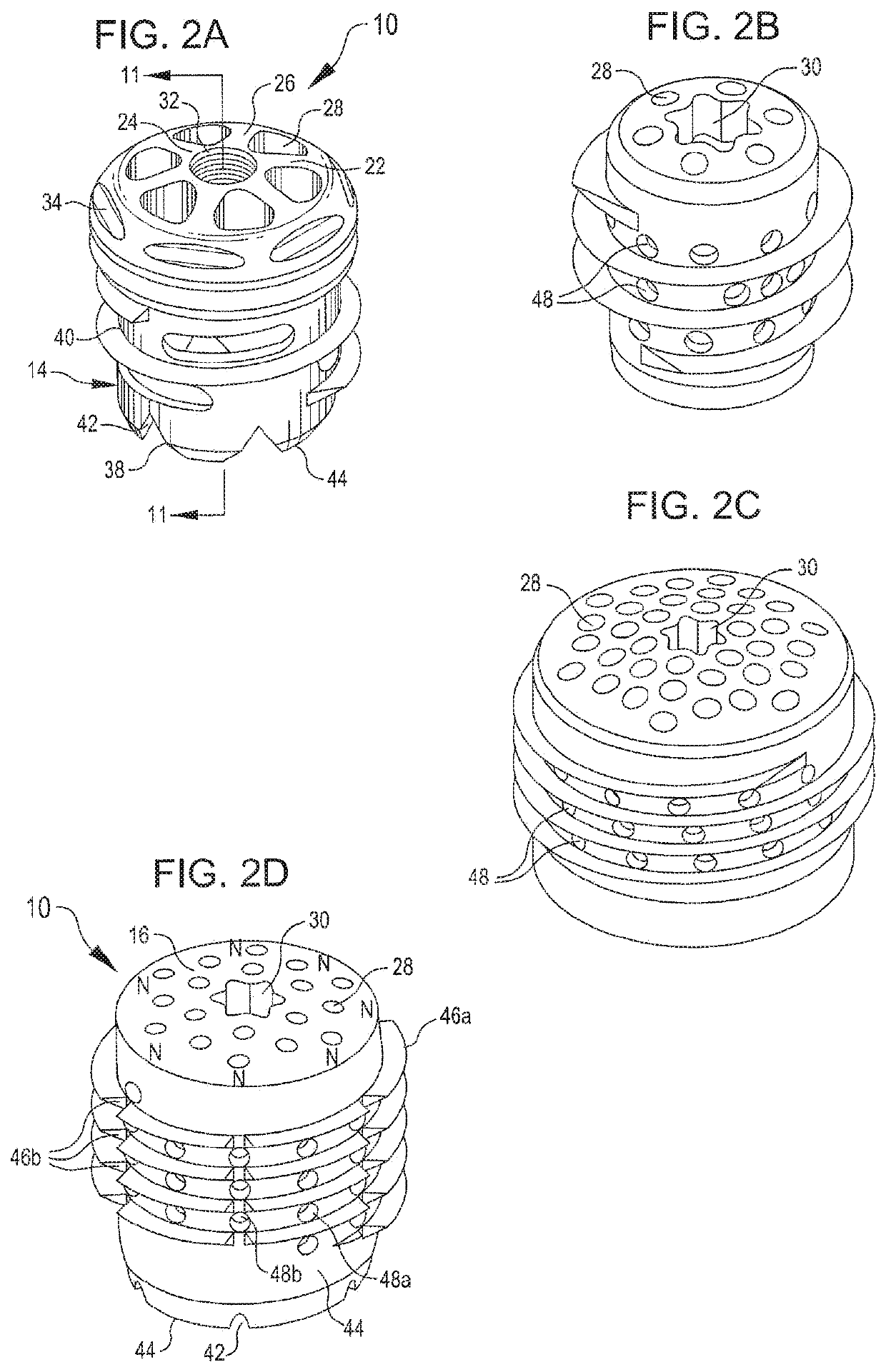 Methods, systems and devices for repairing anatomical joint conditions