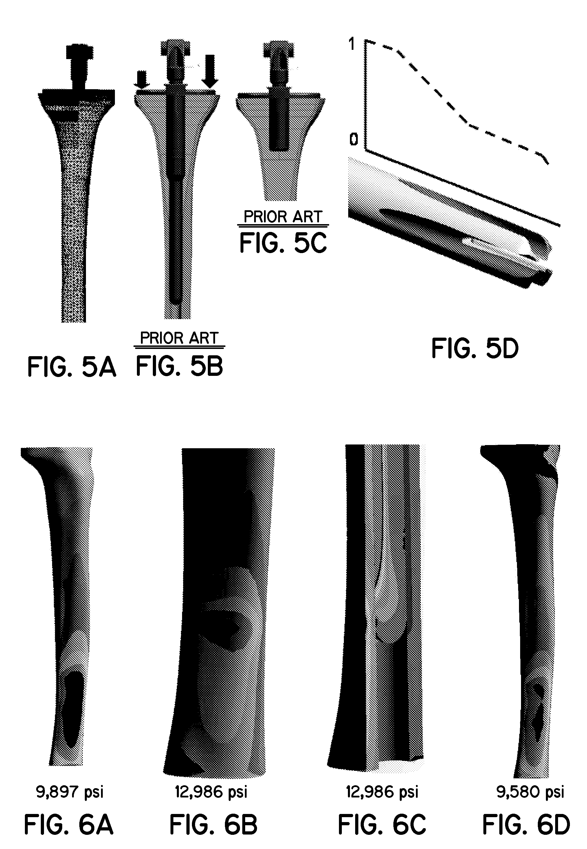 Variable stiffness intramedullary stem