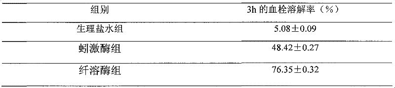 cDNA sequence coding fibrinolysin, amino acid sequence and applications of sequences