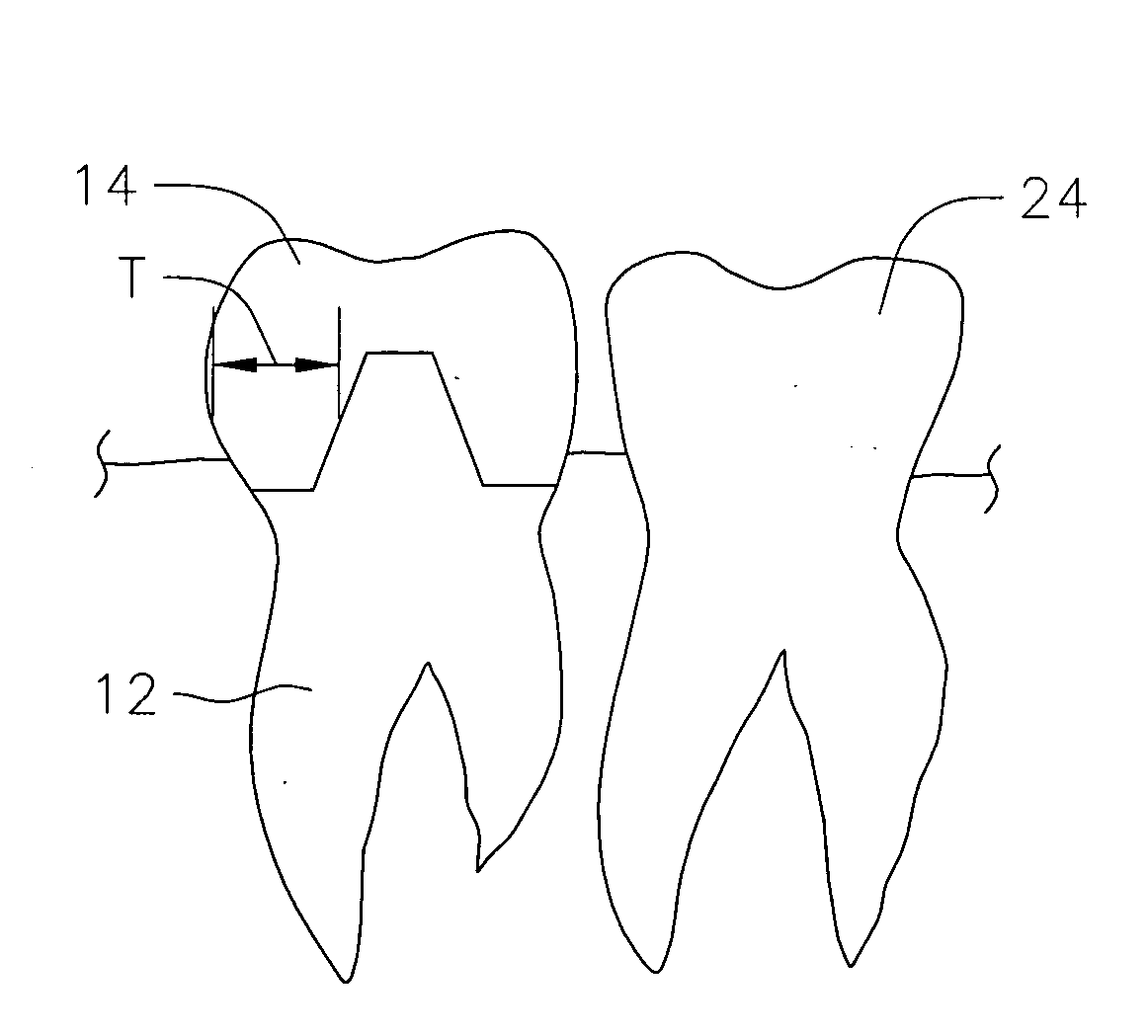 Method and apparatus for selecting translucent dental materials