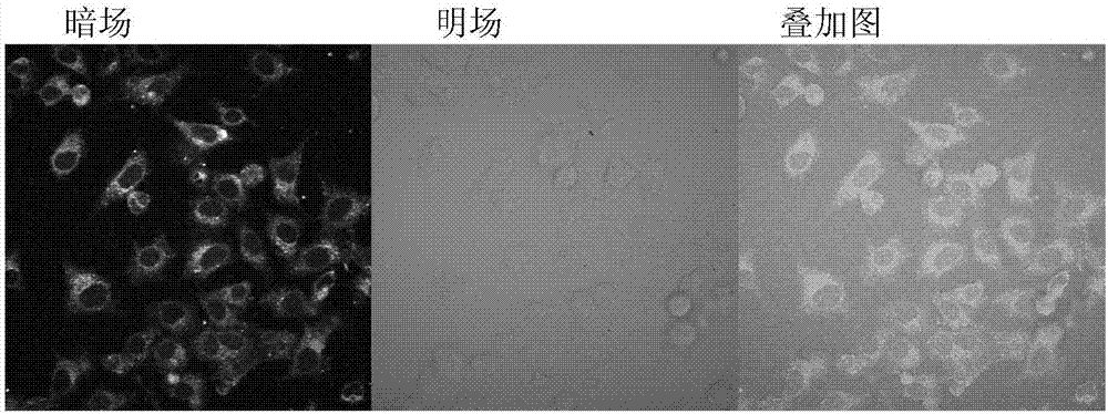 Preparation method and application method of double biological optical window targeted nanometer biological probe