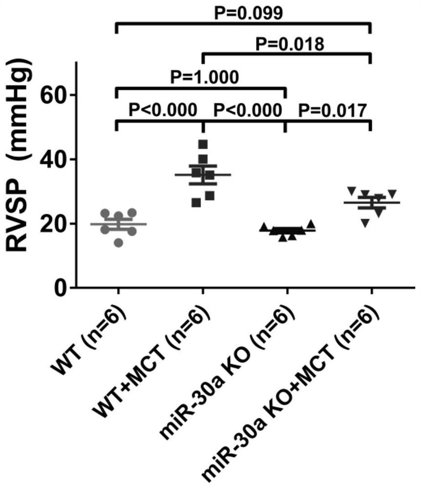 microRNA-30a inhibitor for treating pulmonary arterial hypertension and application of microRNA-30a inhibitor