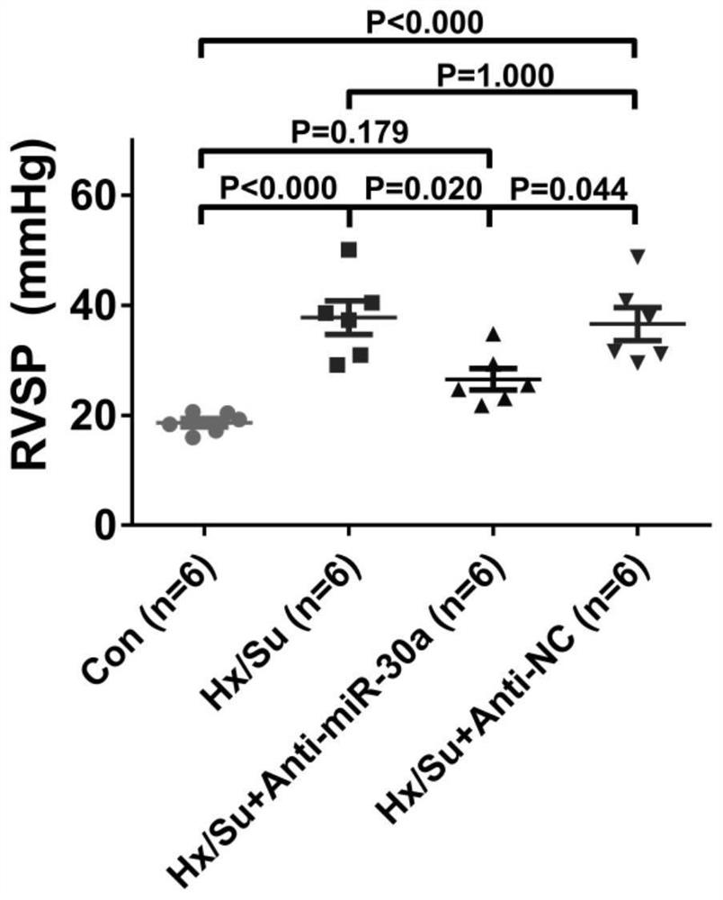 microRNA-30a inhibitor for treating pulmonary arterial hypertension and application of microRNA-30a inhibitor