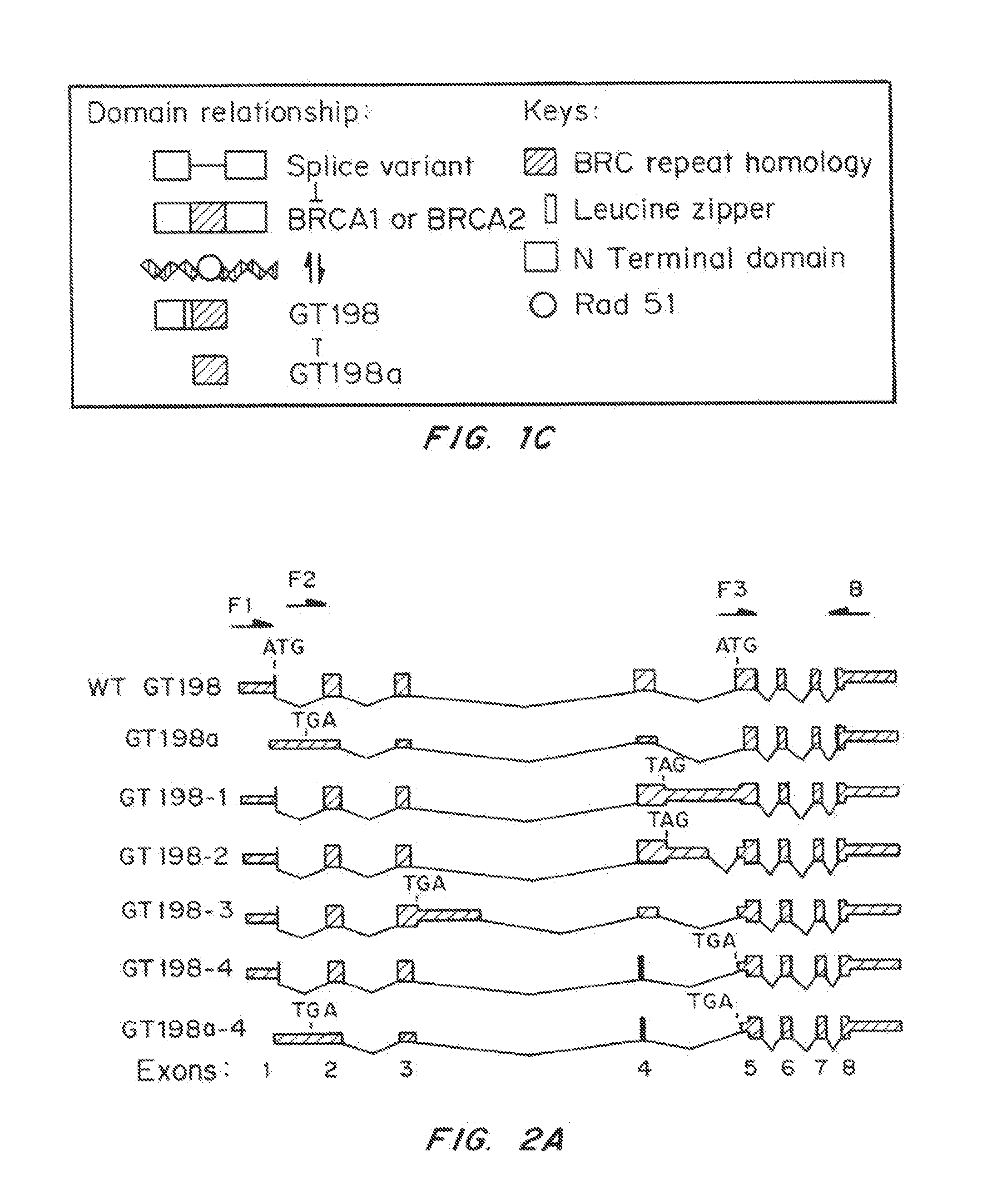 Breast Cancer Susceptibility Gene GT198 and Uses Thereof