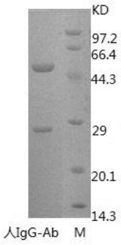 Anti-human IgG monoclonal antibody and hybridoma cell strain and application thereof