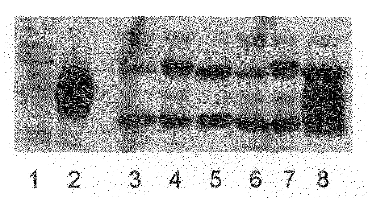 Methods and Kits for Early Detection of Cancer or Predisposition Thereto