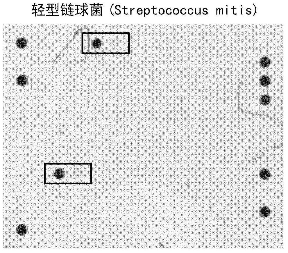 Detection of Streptococcus pneumoniae