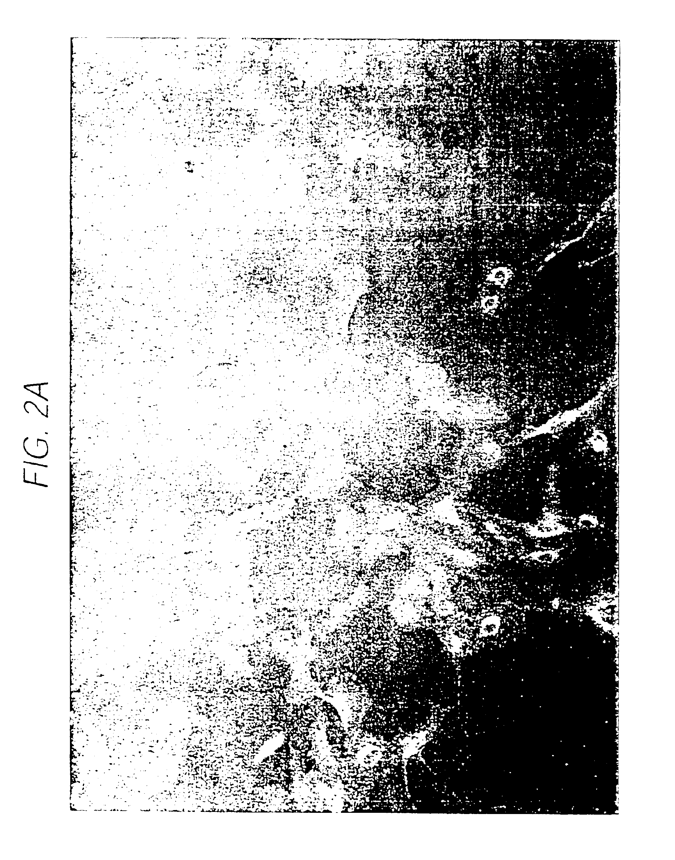 Vascular coating composition