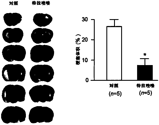 Quinazoline derivative used for cardio cerebrovascular diseases