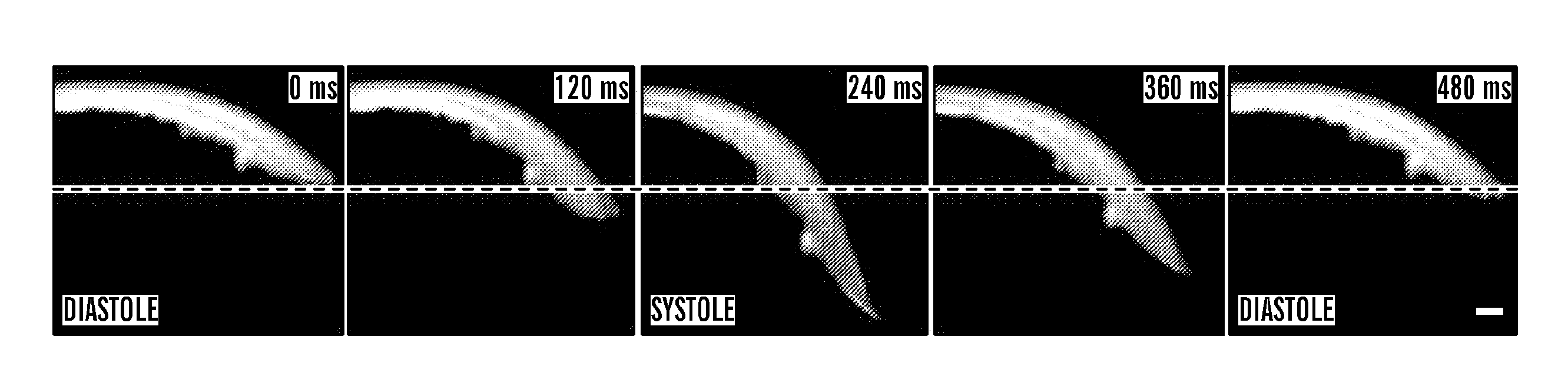 Tissue engineered myocardium and methods of production and uses thereof