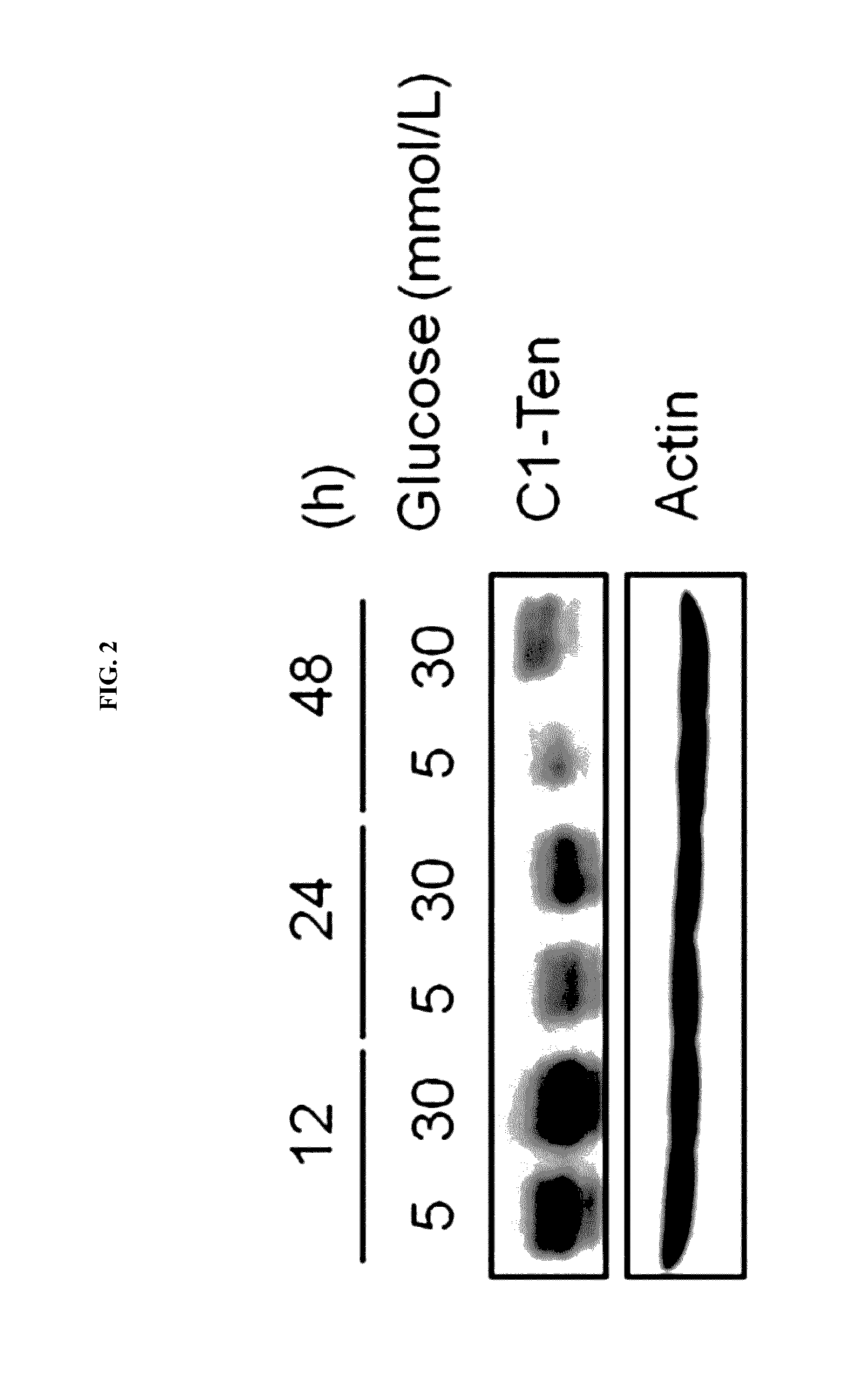 Pharmaceutical compositions for preventing or treating diabetic nephropathy comprising the activity inhibitor of tenc1