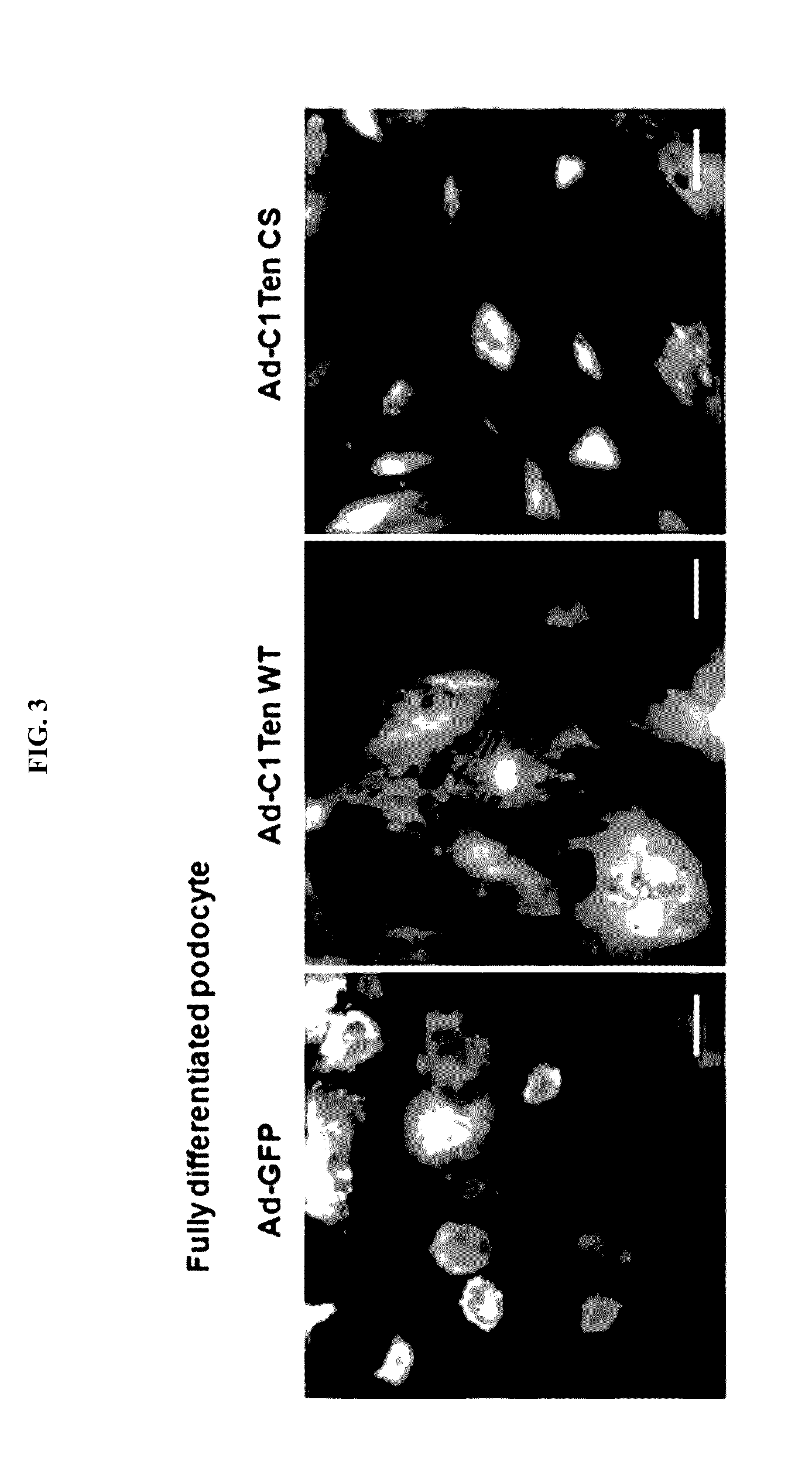 Pharmaceutical compositions for preventing or treating diabetic nephropathy comprising the activity inhibitor of tenc1