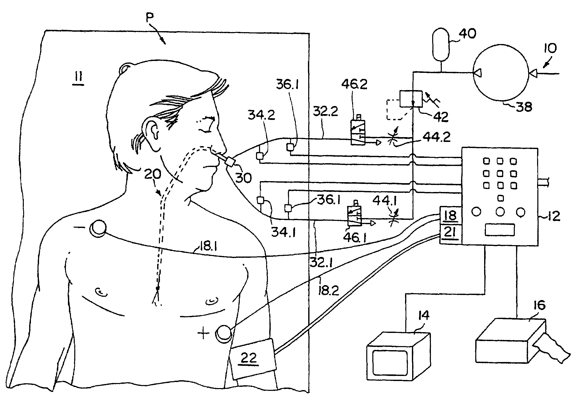 Method of determining cardiac indicators