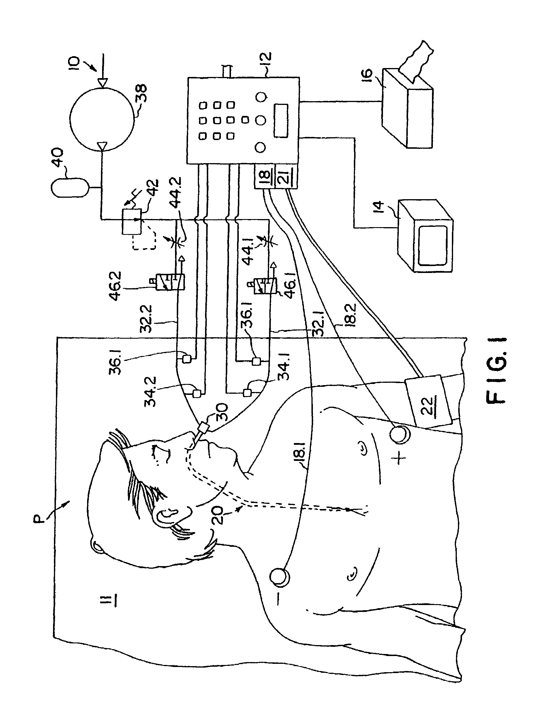 Method of determining cardiac indicators