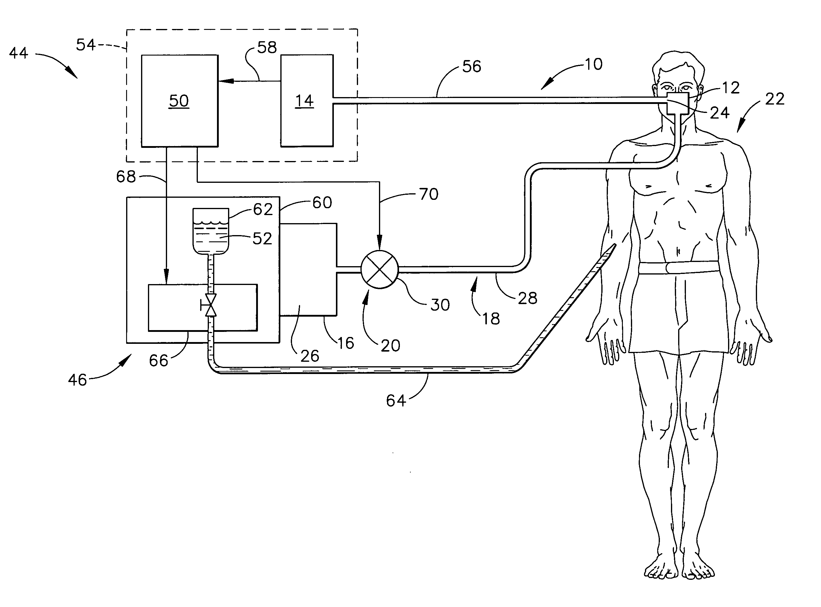 Cannula assembly and medical system employing a known carbon dioxide gas concentration