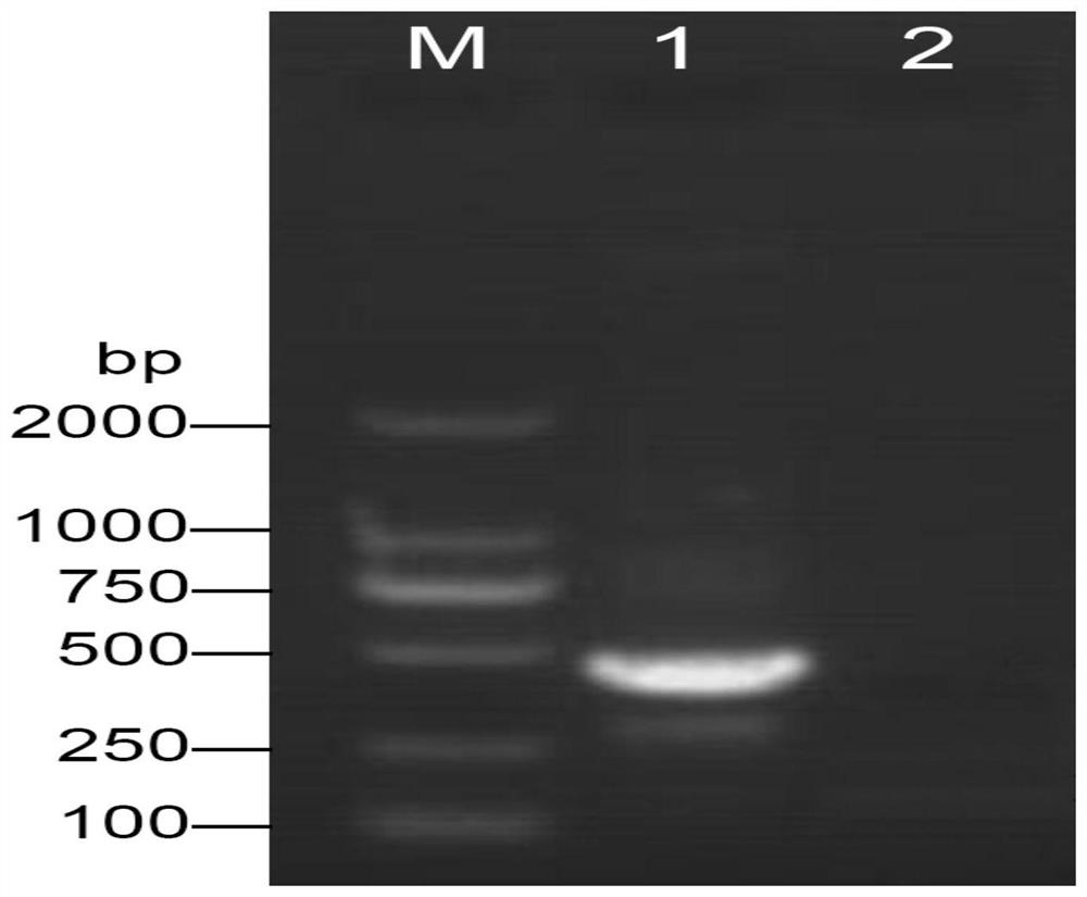 Primer group, probe, kit and detection method for rapidly identifying novel coronavirus